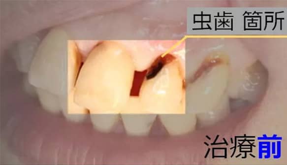 治療前