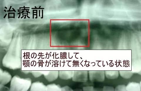 治療前