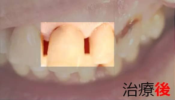 治療後