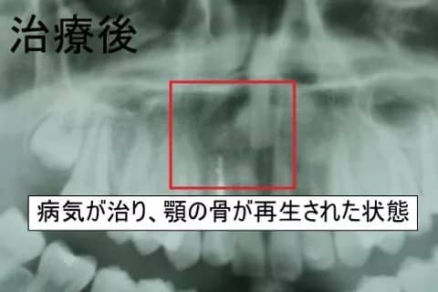 治療後