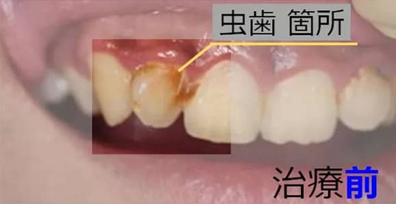 治療前