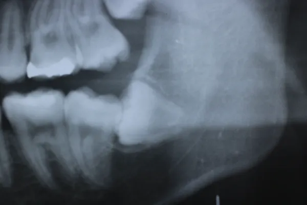 Case16