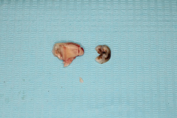 Case16