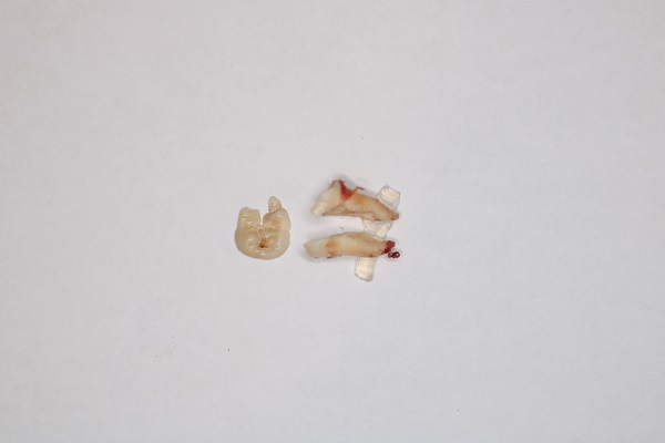 Case16