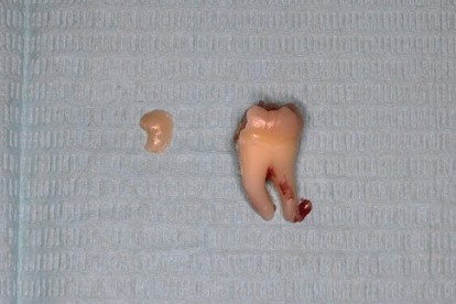Case18