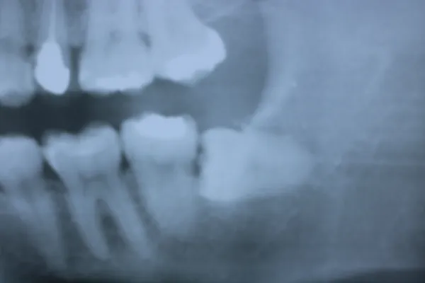 Case10