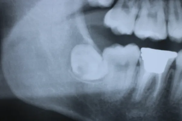 Case15