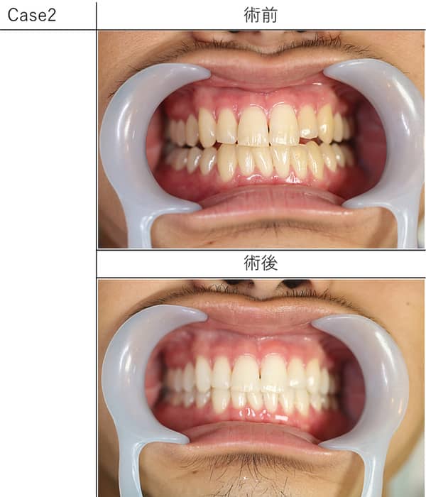 Case2